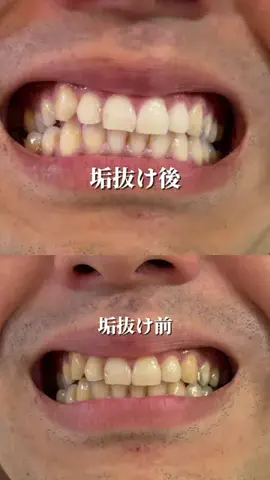 話題の美容【公式】のTikTok投稿