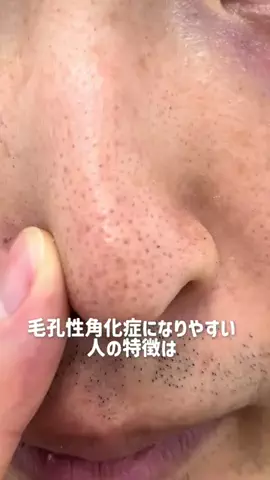 りん美容🫧のTikTok投稿