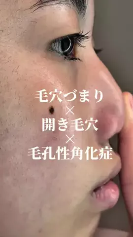 瑠奈🦄のTikTok投稿