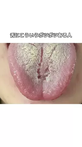 流星のTikTok投稿