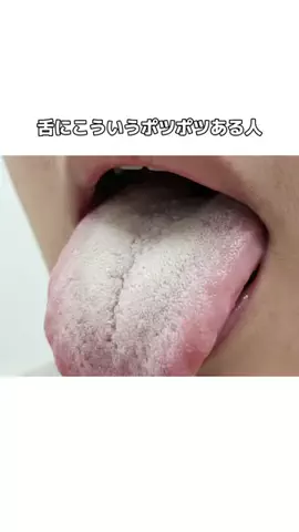 流星のTikTok投稿