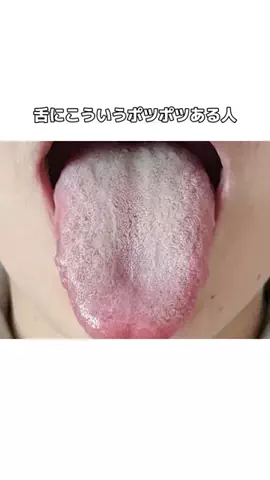 流星のTikTok投稿