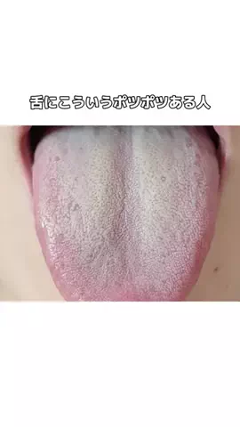流星のTikTok投稿