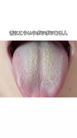 流星のTikTok投稿