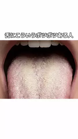 流星のTikTok投稿