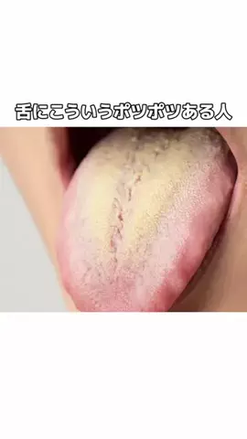 流星のTikTok投稿
