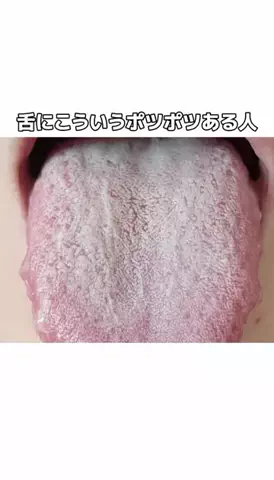 流星のTikTok投稿