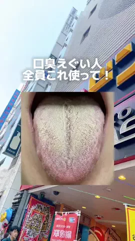 流星のTikTok投稿