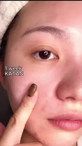 泡ちゃん@美容のTikTok PR投稿：話題のKATAN、一週間使ってみた！#垢抜け #美容 #シミ #katan…