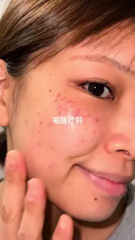 すず🩵のTikTok投稿