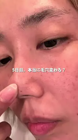 ももかの美容メモ🫧のTikTok投稿