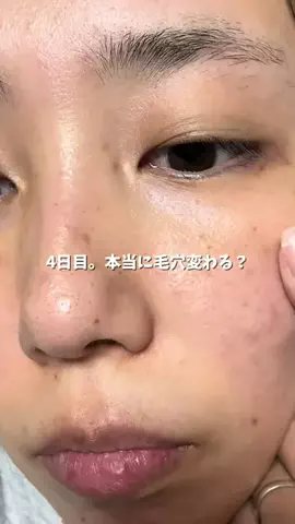 ももかの美容メモ🫧のTikTok投稿