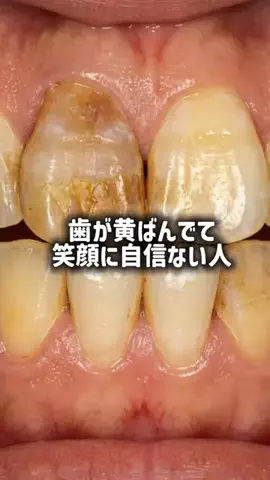 yui_cosme1のTikTok投稿