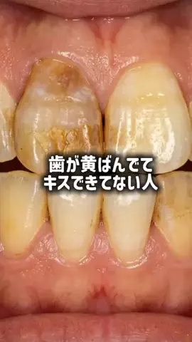 yui_cosme1のTikTok投稿