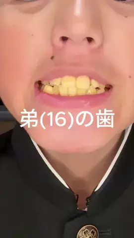 杏仁のTikTok投稿